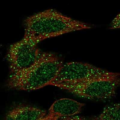 Immunocytochemistry/ Immunofluorescence: CECR6 Antibody [NBP2-55867]