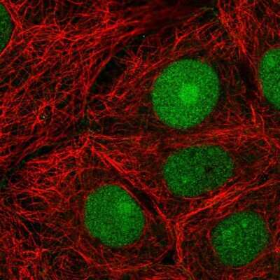 Immunocytochemistry/ Immunofluorescence: CEECAM1 Antibody [NBP2-58669]