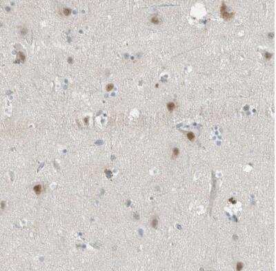 Immunohistochemistry-Paraffin: CEECAM1 Antibody [NBP1-84551]