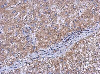 Immunohistochemistry-Paraffin: CEECAM1 Antibody [NBP2-15857]
