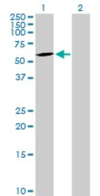 Western Blot: CEECAM1 Antibody [H00051148-B01P]