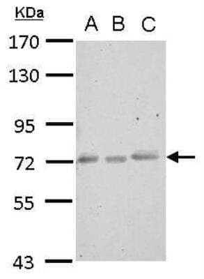 Western Blot: CEECAM1 Antibody [NBP2-15857]