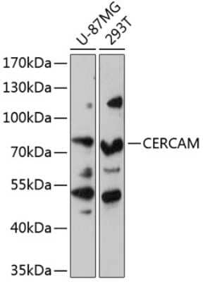 Western Blot: CEECAM1 AntibodyAzide and BSA Free [NBP2-92159]