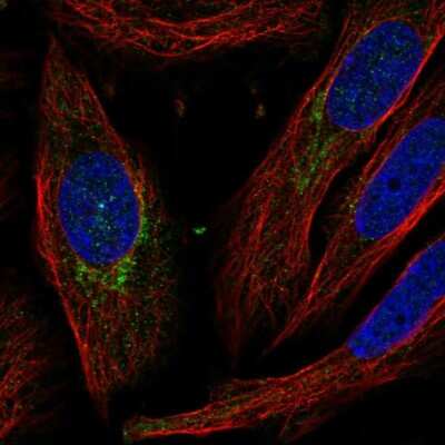 Immunocytochemistry/ Immunofluorescence: CEI Antibody [NBP2-57997]