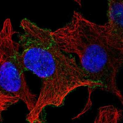 Immunocytochemistry/ Immunofluorescence: CELSR1 Antibody [NBP2-55658]