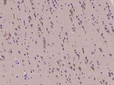 Immunohistochemistry-Paraffin: CELSR2 Antibody [NBP2-98104]