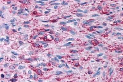Immunohistochemistry-Paraffin: CELSR2 Antibody - BSA Free [NLS1940]