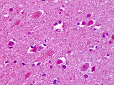 Immunohistochemistry-Paraffin: CELSR2 Antibody - BSA Free [NLS1943]