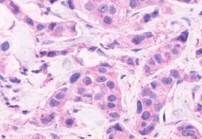 Immunohistochemistry-Paraffin: CELSR2 Antibody - BSA Free [NLS1943]