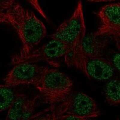 Immunocytochemistry/ Immunofluorescence: CEMP1 Antibody [NBP3-17226]