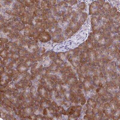 Immunohistochemistry-Paraffin: CEMP1 Antibody [NBP2-31682]