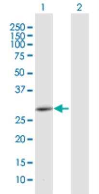 Western Blot: CEMP1 Antibody [H00752014-B01P-50ug]