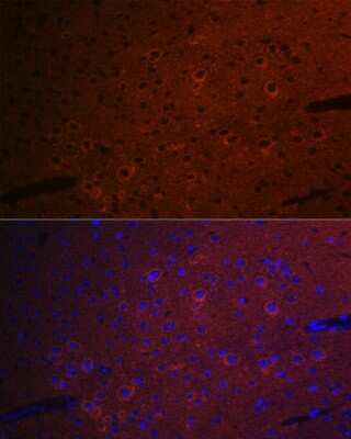 Immunocytochemistry/ Immunofluorescence: CEND1 Antibody (1D3Z1) [NBP3-16614]