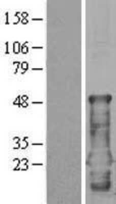 Western Blot: CEND1 Overexpression Lysate [NBP2-04361]