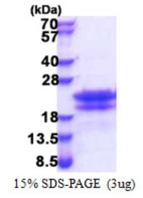 SDS-PAGE: Recombinant Human CEND1 His Protein [NBP2-22763]