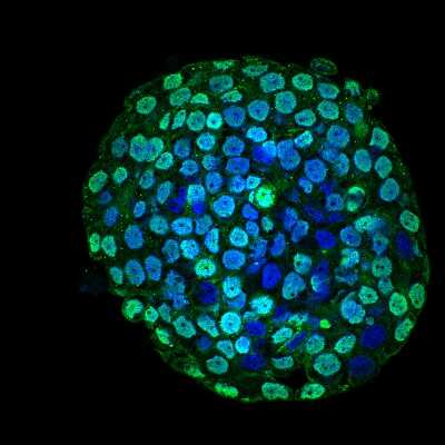 Immunocytochemistry/ Immunofluorescence: CENPA Antibody (5A7-2E11) [NBP2-12892]