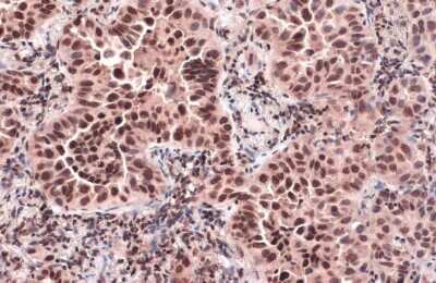 Immunohistochemistry-Paraffin: CENPA Antibody [NBP3-13389]