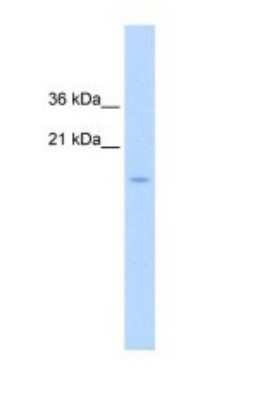 Western Blot: CENPA Antibody [NBP1-52937]