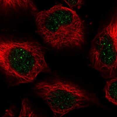 Immunocytochemistry/ Immunofluorescence: CENPB Antibody [NBP2-55433]