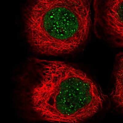 Immunocytochemistry/ Immunofluorescence: CENPB Antibody [NBP2-58179]