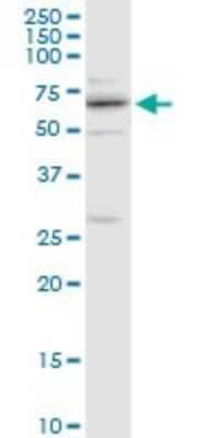 Western Blot: CENPB Antibody [H00001059-B01P]