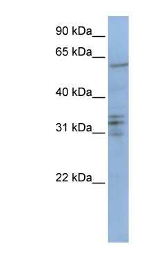 Western Blot: CENPB Antibody [NBP1-58103]