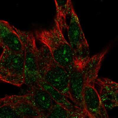 Immunocytochemistry/ Immunofluorescence: CENPBD1 Antibody [NBP2-56651]