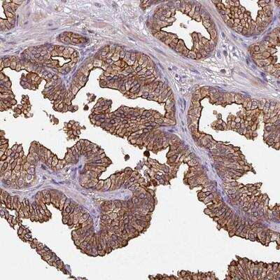 Immunohistochemistry-Paraffin: CENPBD1 Antibody [NBP2-14771]