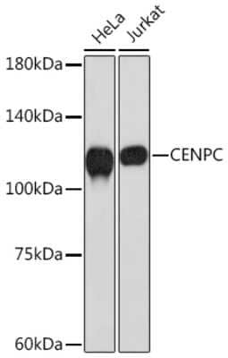 Western Blot: CENPC Antibody (5E3K5) [NBP3-16305]