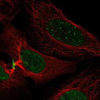 Immunocytochemistry/ Immunofluorescence: CENPC Antibody [NBP2-55474]