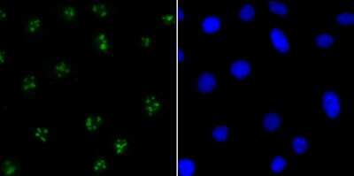 Immunocytochemistry/ Immunofluorescence: CENPC Antibody (JG36-15) [NBP2-75438]