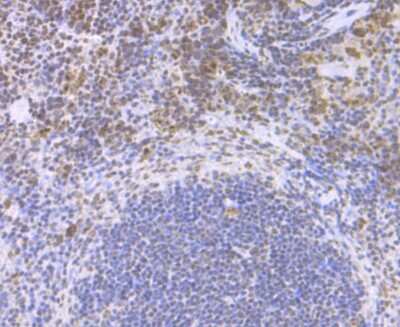 Immunohistochemistry-Paraffin: CENPC Antibody (JG36-15) [NBP2-75438]