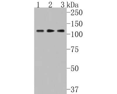 Western Blot: CENPC Antibody (JG36-15) [NBP2-75438]