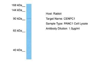 Western Blot: CENPC Antibody [NBP2-84647]