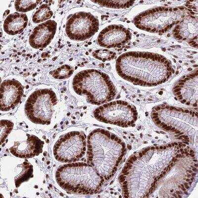 Immunohistochemistry-Paraffin: CENPE Antibody [NBP1-82875]