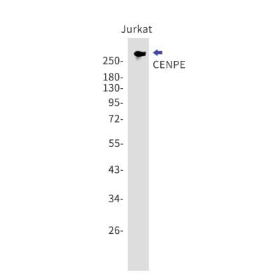 Western Blot: CENPE Antibody (S06-1G4) [NBP3-19602]