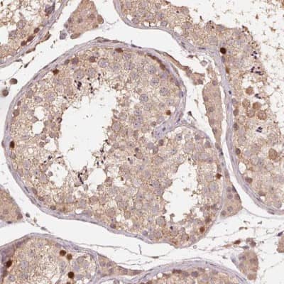 Immunohistochemistry-Paraffin: CENPF Antibody [NBP2-62641]