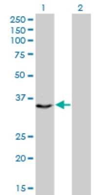 Western Blot: CENPH Antibody (1F7) [H00064946-M01]