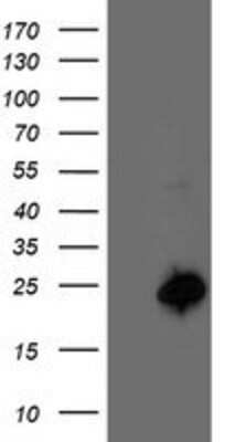 Western Blot: CENPH Antibody (OTI2G4) [NBP2-01449]