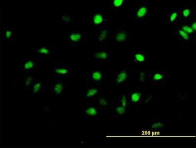 Immunocytochemistry/ Immunofluorescence: CENPH Antibody [H00064946-B02P]