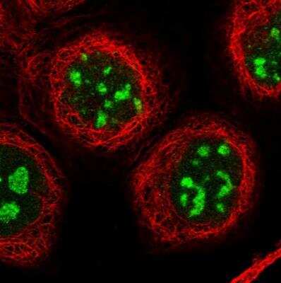 Immunocytochemistry/ Immunofluorescence: CENPH Antibody [NBP1-82546]