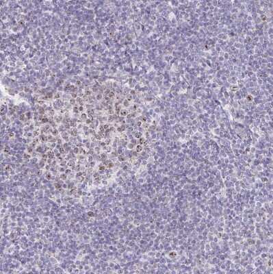 Immunohistochemistry-Paraffin: CENPH Antibody [NBP1-82546]