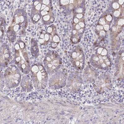 Immunohistochemistry-Paraffin: CENPH Antibody [NBP1-82546]