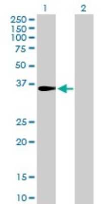 Western Blot: CENPH Antibody [H00064946-B01P]