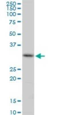 Western Blot: CENPH Antibody [H00064946-B02P]