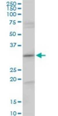 Western Blot: CENPH Antibody [H00064946-B02P]