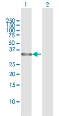 Western Blot: CENPH Antibody [H00064946-B02P]