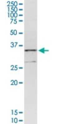 Western Blot: CENPH Antibody [H00064946-D01P]