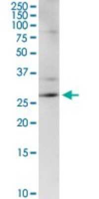 Western Blot: CENPH Antibody [H00064946-D01P]