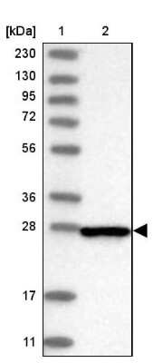 Western Blot: CENPH Antibody [NBP1-82546]